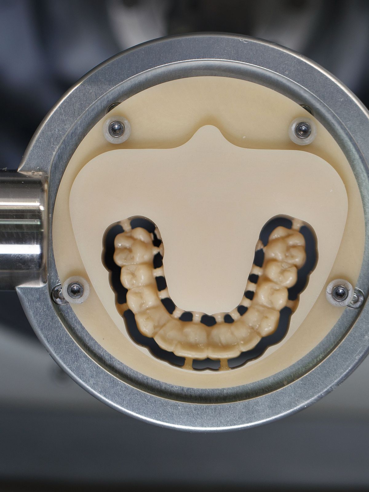 Digital Denture featured image