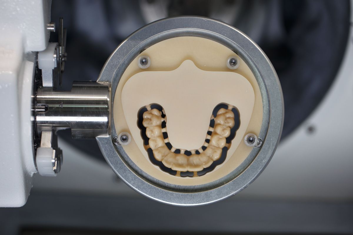 Digital Denture featured image