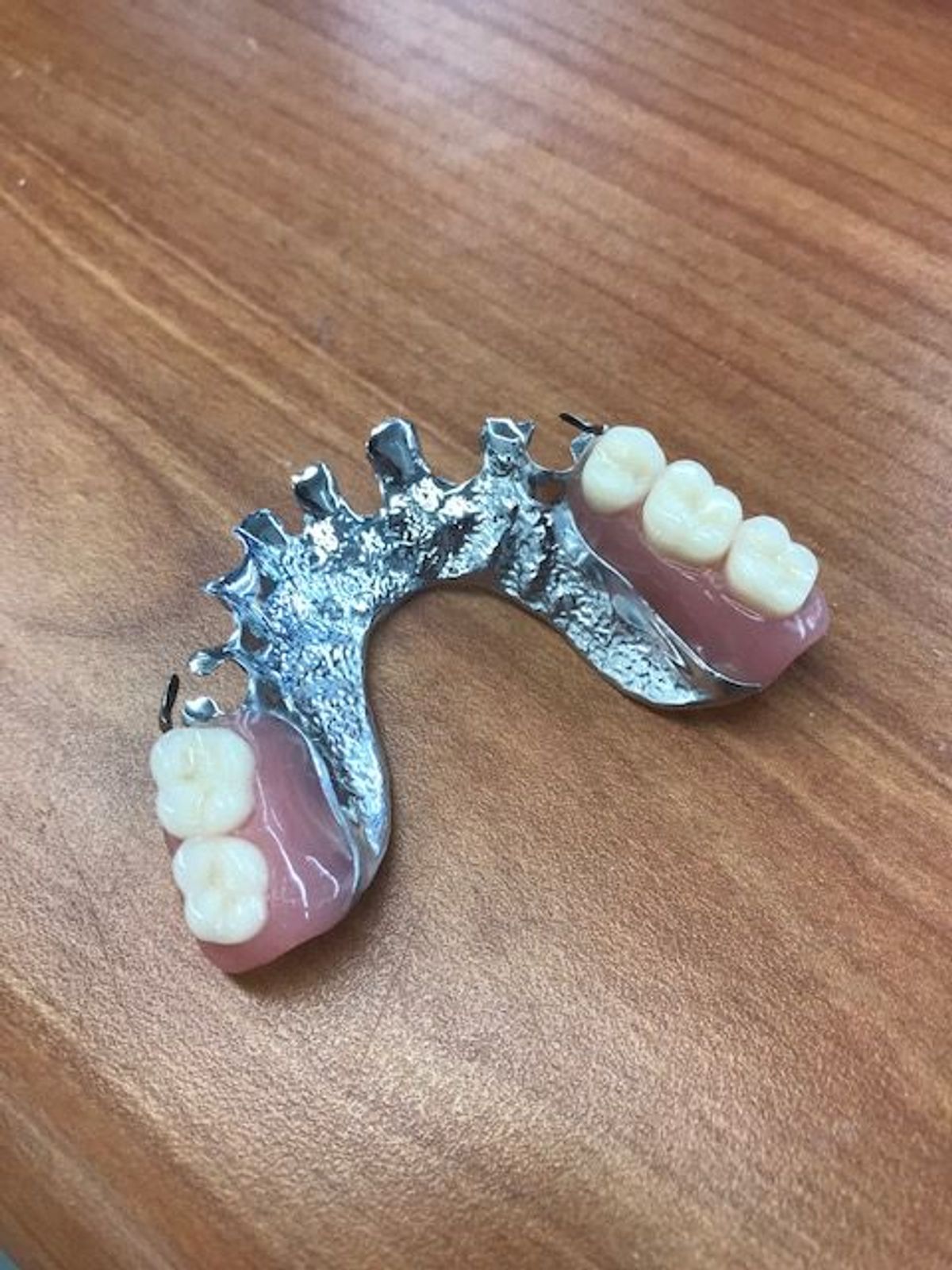 Chrome Partial Denture featured image